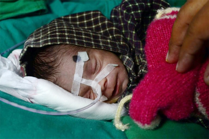 “Phép thần kỳ” đến với bé sơ sinh ở Ấn Độ

